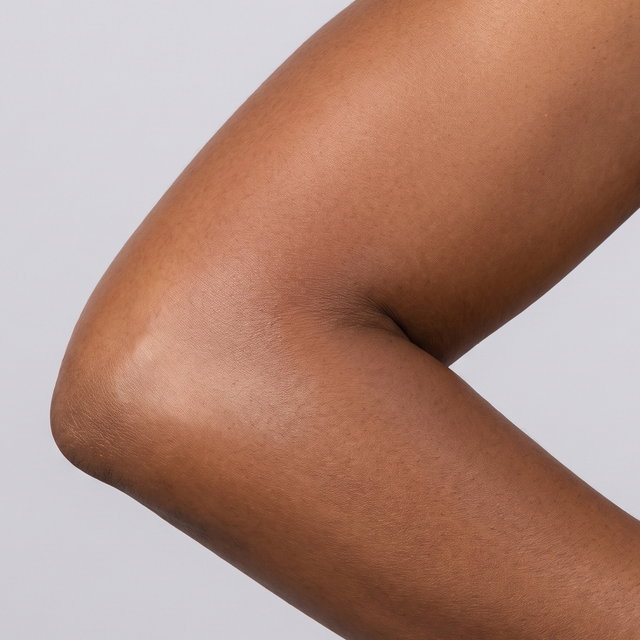 Elbow after - smooth, hydrated, even tone