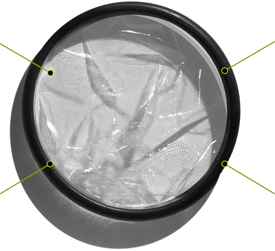 Placeholder: labeled diagram of disc features